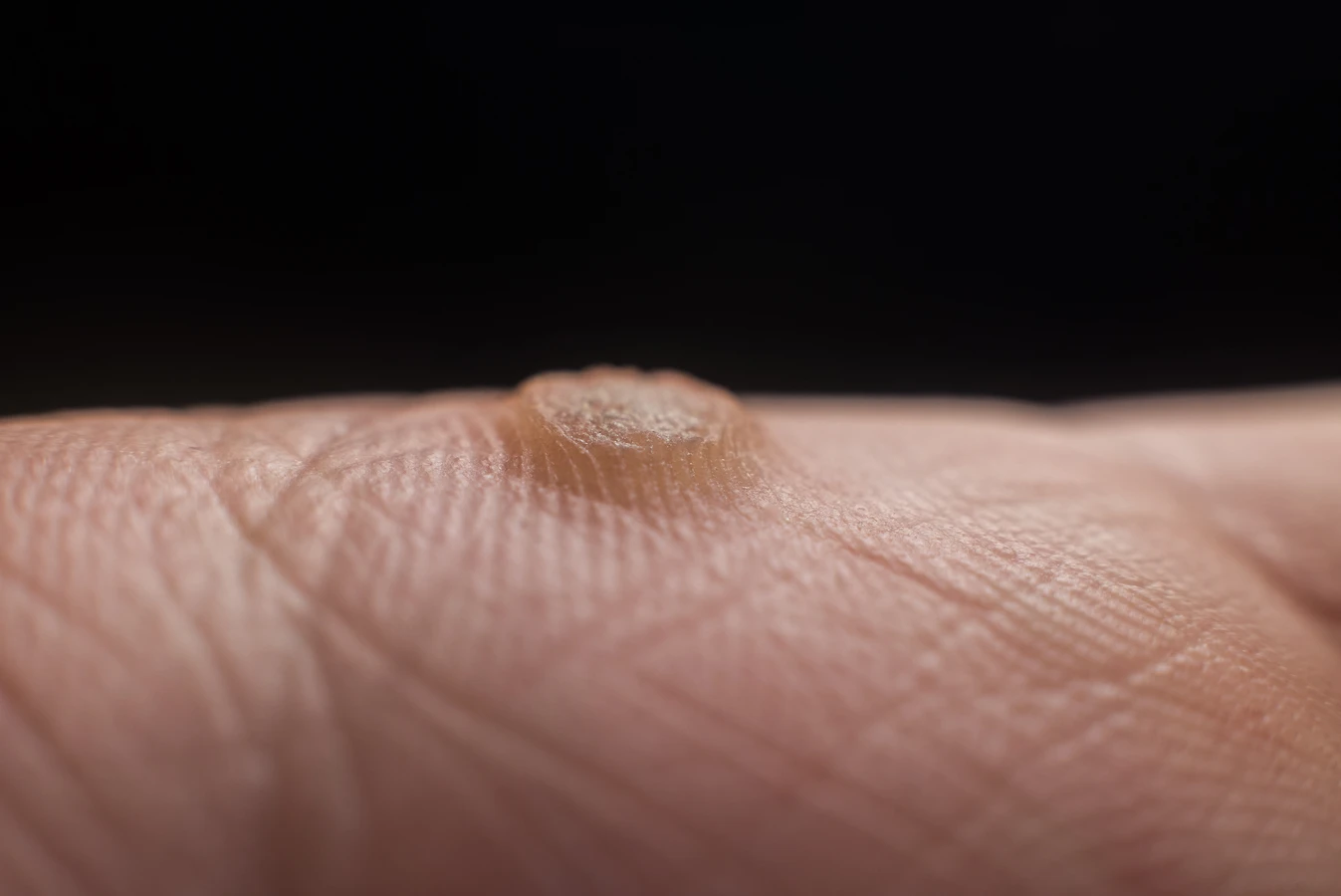 Jak znaleźć dobrego podologa?