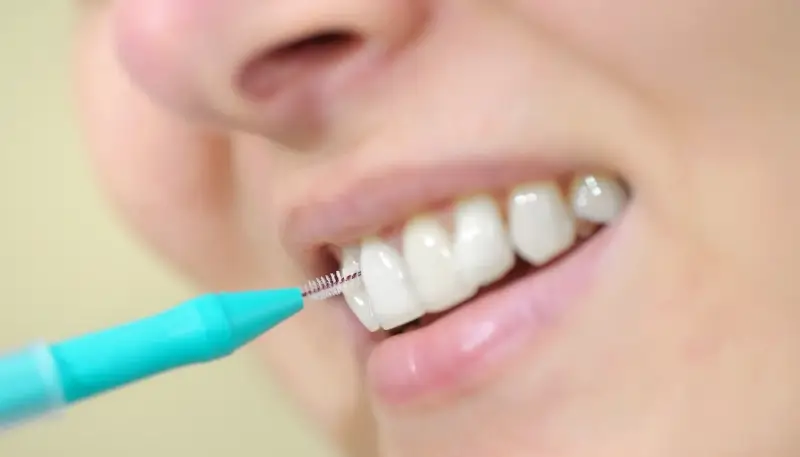 Jak długo trwa leczenie kanałowe?